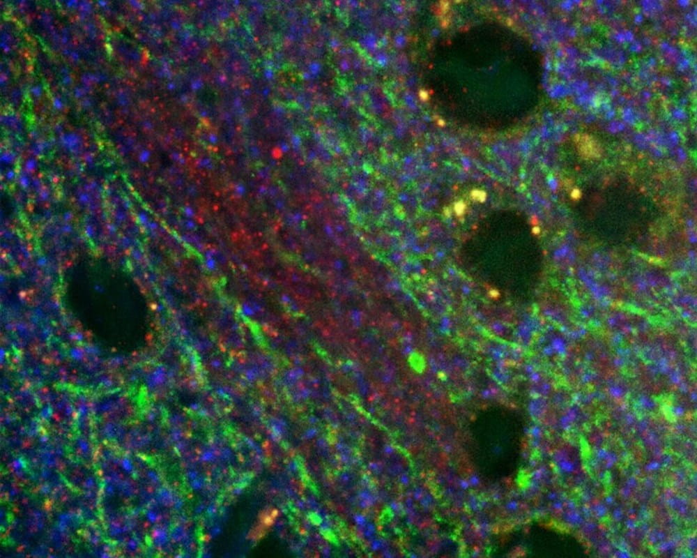 Postsynaptic density protein-95 in the brain