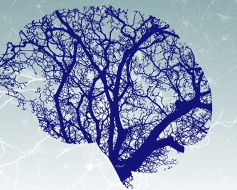 A brain outline with a blue tree with it's branches filling up the outline of the brain. 