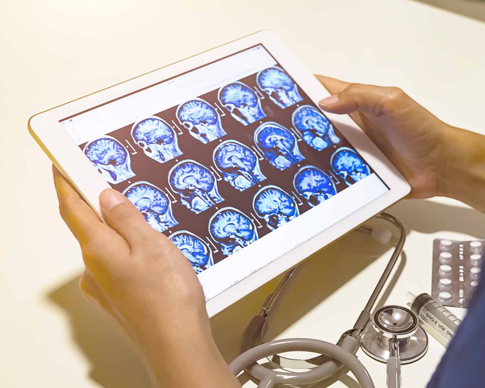 Clinician looking at a brain scan on a tablet