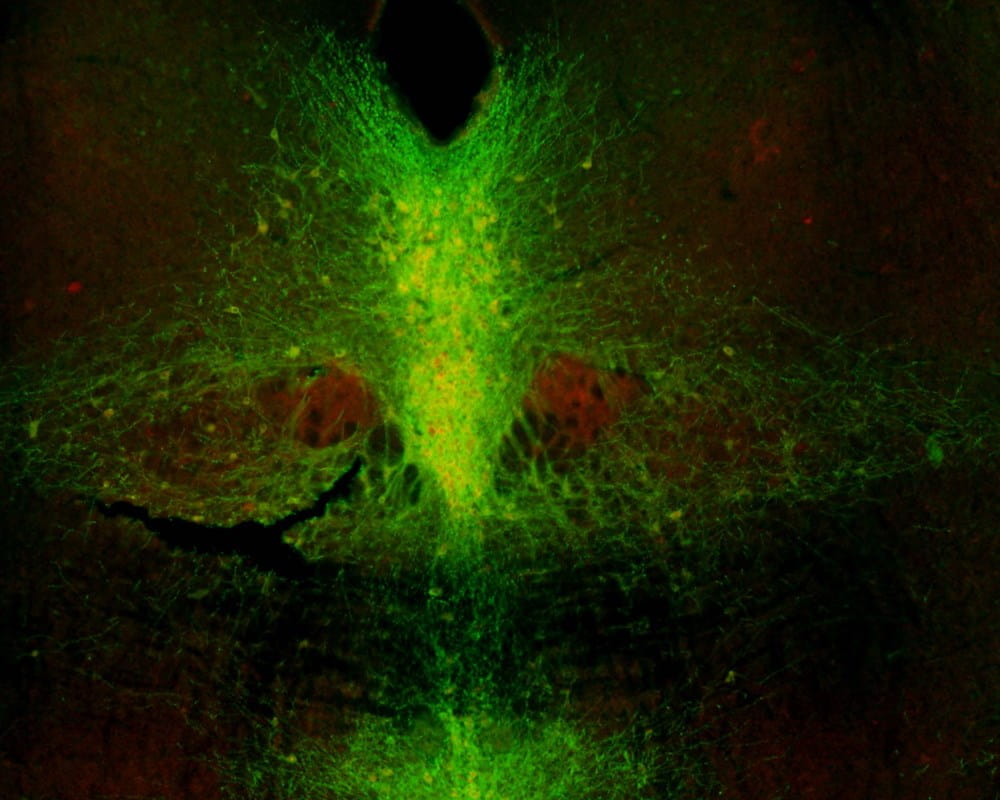 Optogenetics